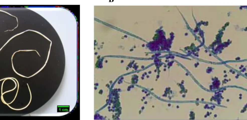 Figura 1 - Morfologia do parasita Dirofilaria immitis: A) adultos e B) microfilárias 