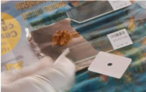 Figure 14. Step 6 of Kato-Katz thick smear.  Figure 15. Kato-Katz thick smears ready  for observation
