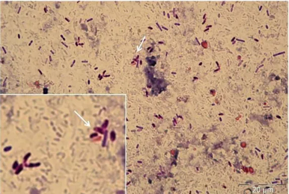Figura 4 - Fotografia de esporos de microsporidia, em esfregaço fecal, corado por Gram- Gram-Chromotrope
