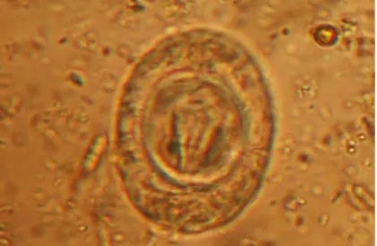 Figura  6  - Fotografia  de  ovo  de  H.  nana,  em  esfregaço  fecal,  corado  por  lugol