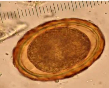 Figura  7  -  Fotografia  de  ovo  de  A.  lumbricoides,  em  esfregaço  fecal,  corado  por  lugol