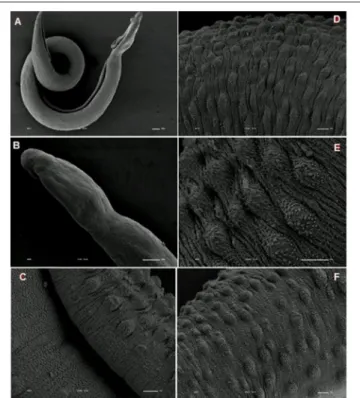 FIGURE 9 | Scanning electron microscopy of S. mansoni PZQ-resistant strain adult males of control group kept in RPMI-1640 drug free medium for 3 h