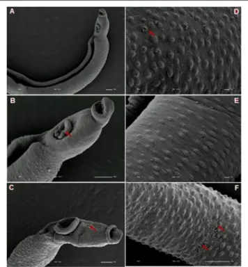 FIGURE 10 | Scanning electron microscopy of S. mansoni