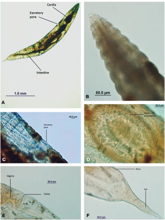 FIGURE 1: Gryllophila skrjabini. (A) Female, entire. (B) Cephalic region. (C) Excretory pore (maximized)