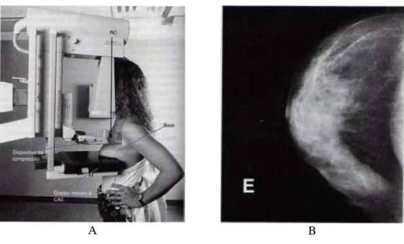 Figura 2.6  – (A) Mamógrafo e (B) mamografia da mama esquerda em incidência craniocaudal