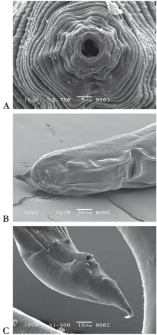 FIGURE 3. Blatticola cristovata n. sp. SEM photographs. A. Female  stoma showing mouth opening