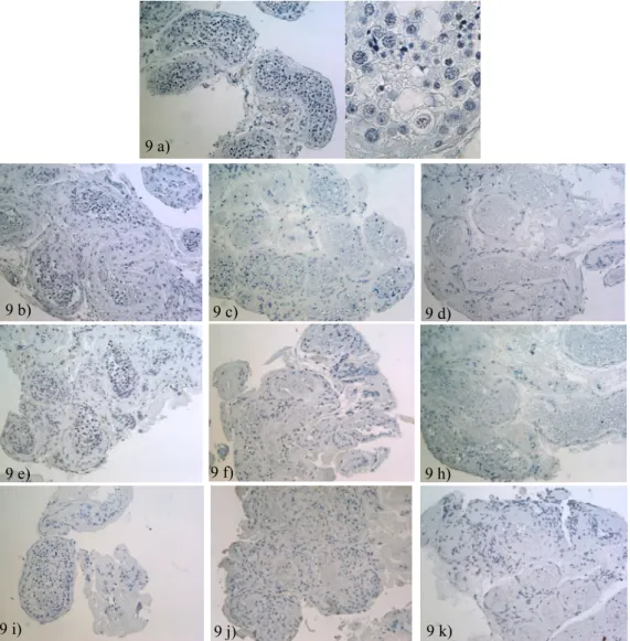 Figura 9 -Morfologia dos túbulos seminíferos nos dias 0 (9a), 7 (9b, e, i), 14 (9c, f, j), e 28 (9d,  h, k) de cultura, das experiências controlo (9a – 9d), 50/1 (9e – 9h) e 500/10 (9i – 9k) Note a  subsequente perda de células ao longo dos 28 dias de cult