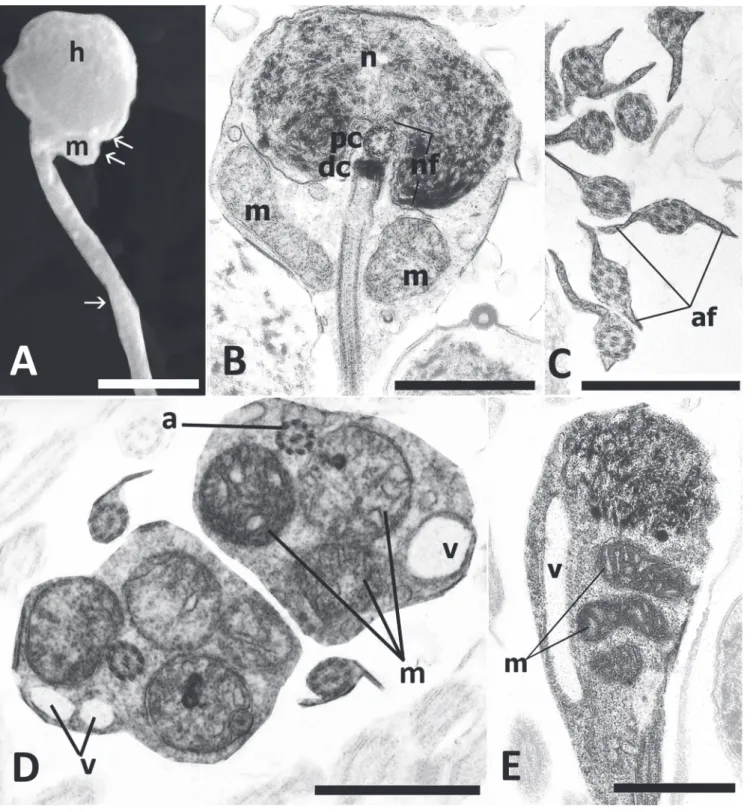 Fig. 3. A: Spermatozoon of Eigenmannia trilineata (SEM), h = sperm head, arrow = flagellum, double arrow = midpiece, m = mitochondrion; B, E: Spermatozoa  of E