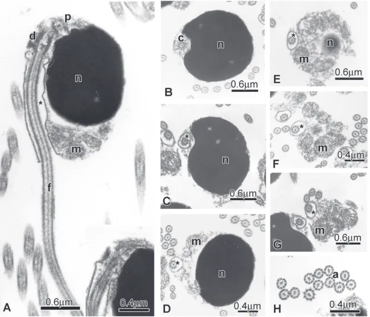 Fig. 13. Spermatozoa of Lepidocharax burnsi (MCP 34828, paratype, 31.9 mm SL) A: Longitudinal section of spermatozoa.