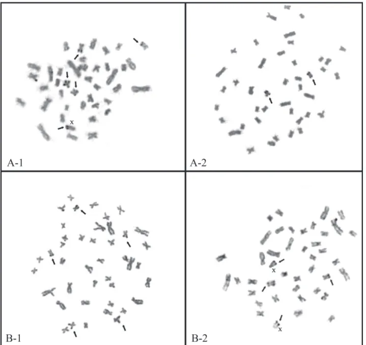 Fig. 3. Variable Ag-NOR patterns in populations of H. malabaricus from middle rio Doce lakes