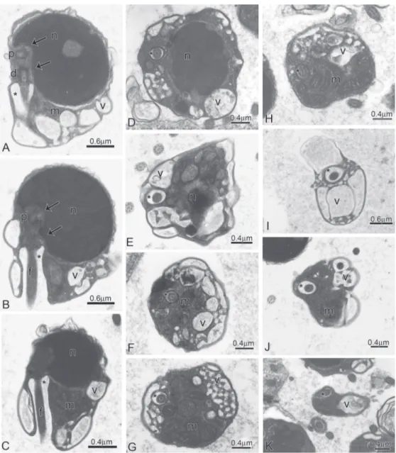 Fig. 8. Spermatozoa of Creagrutus meridionalis. A-C: Longitudinal sections of spermatozoa