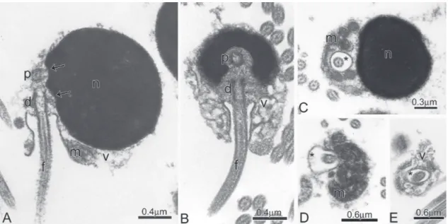 Fig. 5. Spermatozoa of Bryconacidnus ellisi. A-B: Longitudinal sections of spermatozoa
