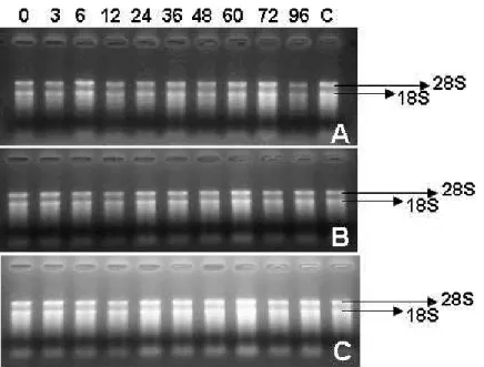 Figura  3.  Eletroforese  em  gel  de  agarose  1,5%  (desnaturante)  de  amostras  de  RNA  total  extraídas de folha de laranja