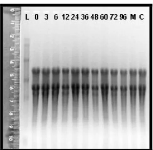 Figura  4.  Eletroforese  em  g el  de  agarose  de  RNA  total  de  folhas  de  laranjeira  inoculadas  com  bactéria,  15µg  em cada  canaleta  (L)  RNA Ladder:  0.24-9.5kb; (0h,  3h,  6h, 12h,  24h, 36h, 48h, 60h, 72h, 96h) todas após inoculação, (M) mi