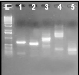 Figura 6.  Eletroforese em gel de agarose (1%) dos fragmentos dos genes por PCR. (L) DNA  ladder  1Kb;  (1)  Chalcona  sintase;  (2)  Fenilalanina  amônia  liase;  (3)  Aleno  oxido  sintase; (4) pr-2 ( -1,3-glucanase); (5) Branco 