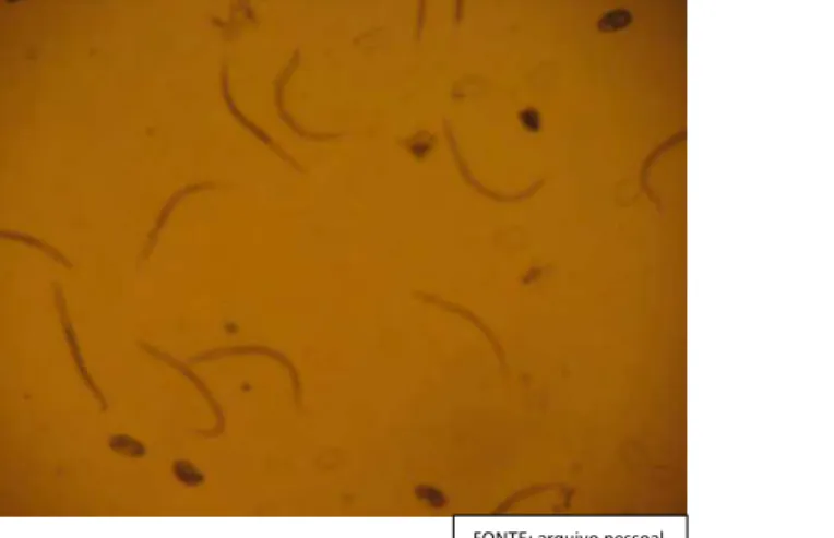 FIGURA  3:  Ovos  de  tricostrongilídeos  não  eclodidos  e  larvas  de  primeiro  estágio  ao  microscópio óptico em aumento x40