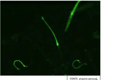 FIGURA  4:  Larvas  de  tricostrongilídeos  de  primeiro  estágio  que  se  alimentaram  com  Escherichia coli marcada com fluoresceína ao microscópio de fluorescência em aumento x40