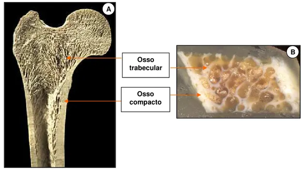 Figura I.5 – Corte transversal do fêmur (A) e da crista ilíaca (B): camada externa de osso compacto e  rede interna de osso trabecular