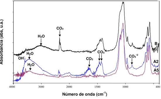 Figura  II.22  –  Espectros  de  FTIR  de  A2  e  A5  sintetizadas  em  pH  7±0,2  com  presença  de  maior  quantidade das moléculas de água; e hidroxiapatita (Oliveira, 2004) sintetizada em pH 10±1 (B)