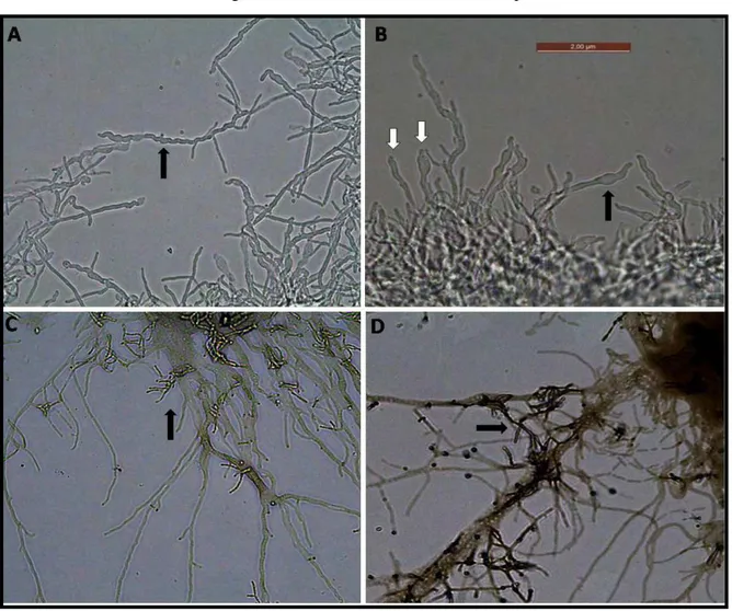 Figura 3: Morfologia do micélio de estirpes de Pseudonocardia spp. 