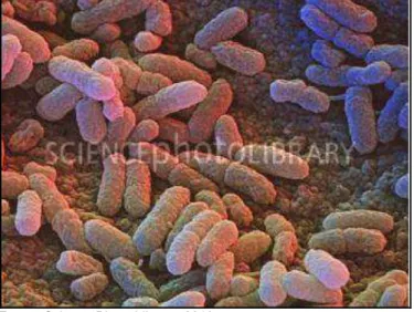 Figura 3. Microscopia eletrônica de varredura de Salmonella enteriditis ampliado 6350 vezes