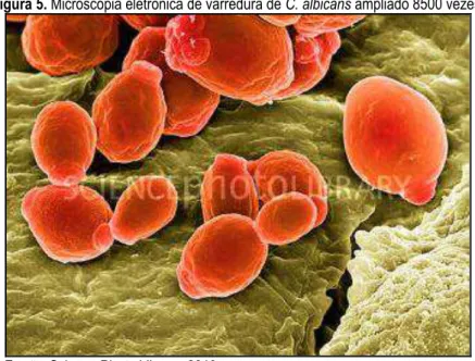 Figura 5. Microscopia eletrônica de varredura de C. albicans ampliado 8500 vezes. 