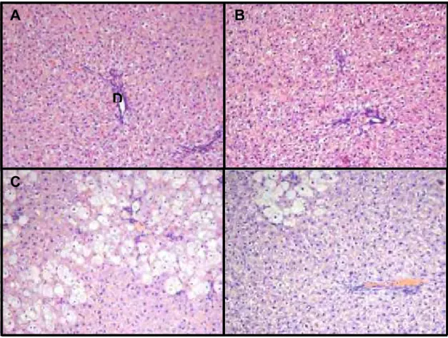 Figura 12. Efeito da bixina na caracterização histopatológica de fígado de  ratos tratados com CCl 4  (200x)