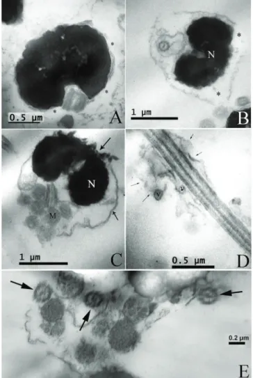 Fig. 4.  Transmission  electron  microscopy  photographs  of  pejerrey post thawed sperm showing different types of  alter-ations