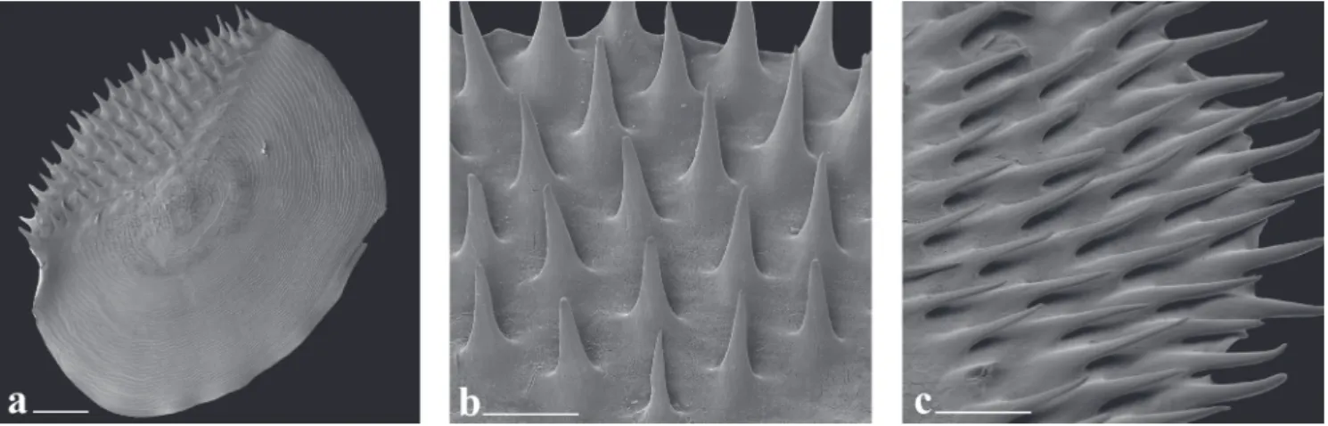 Fig. 8.  Scanning electron microscope images of the spinoid scales of  Galeocharax goeldii , UFRO-I 9668, 160.8 mm SL