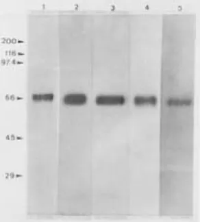 Fig. 1: immunoprecipitation of anti-GP63 monoclonal antibod- antibod-ies derived from five specantibod-ies/strains of Leishmania