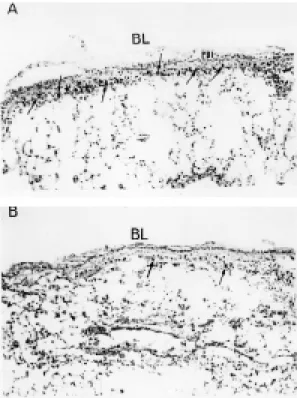 Fig. 1: cyanide-resistant eosinophil peroxidase activity in the bronchial wall of sensitized saline- or antigen-challenged mice.