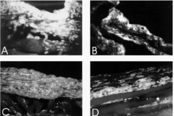 Fig. 5: adhesion molecules expression, in air pouch wall of normal and infected mice, after 8 hr of stimulation