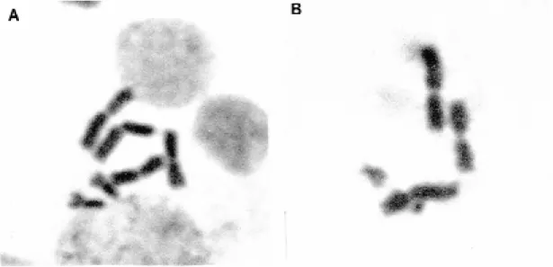 Fig. 3: giemsa-staining metaphase chromosome preparations from LSB-AA695BB cell line showing: A