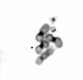 Fig. 4: metaphase karyotype from LSB-AA695BB cell line showing centromeric bands.