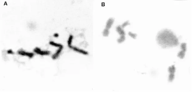 Fig. 6: metaphase karyotypes from LSB-AA695BB cell line A: male; B: female.
