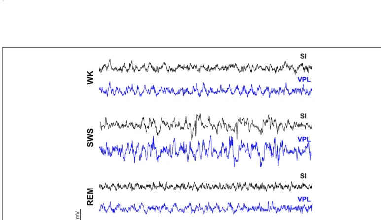 FIGURE A2 | Oscillations on intracranial local field potentials (LFPs) recorded in one session during the dark phase (SHAM-baseline period) simultaneously in the primary somatosensory cortex (SI, black trace) and in the