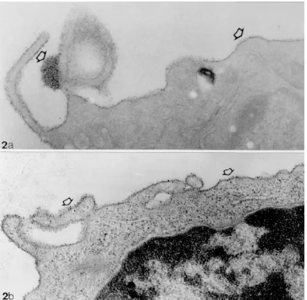 Fig. 2a: monocyte from the young opossum fixed at room temperature for 1 hr, incubated with cationized ferritin (CF) during the same time and observed without contrastation