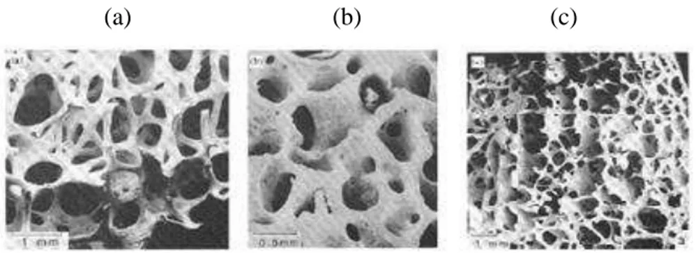 Figura  1.2-  Imagem  de  MEV  mostrando  a  estrutura  porosa  do  trabecular  ósseo