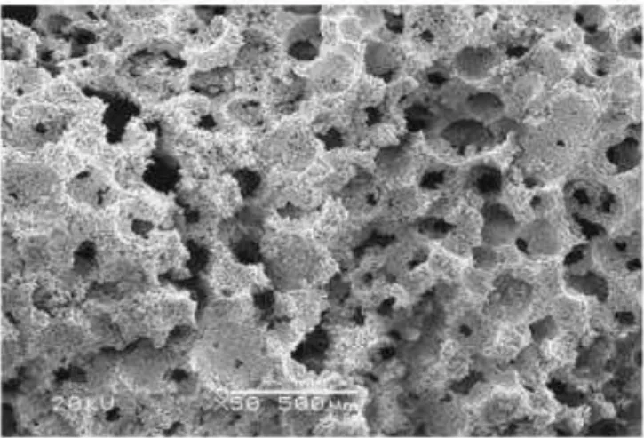 Figura  1.10-  Imagem  de  MEV  do  arcabouço  confeccionado  com  82%  de  parafina  (MACHADO et al., 2009)
