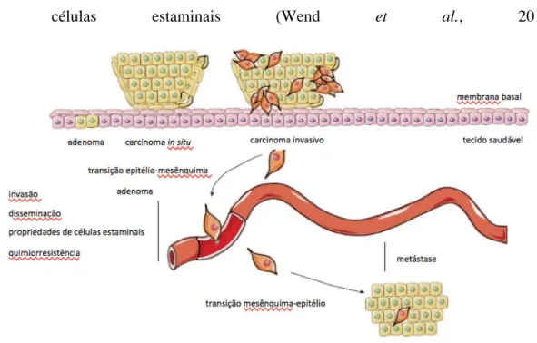 Figura 2: Transição epitélio-mesênquima e transição mesênquima-epitélio durante a progressão do cancro  da mama (Adaptado de Moyret-Lalle  et al., 2014)
