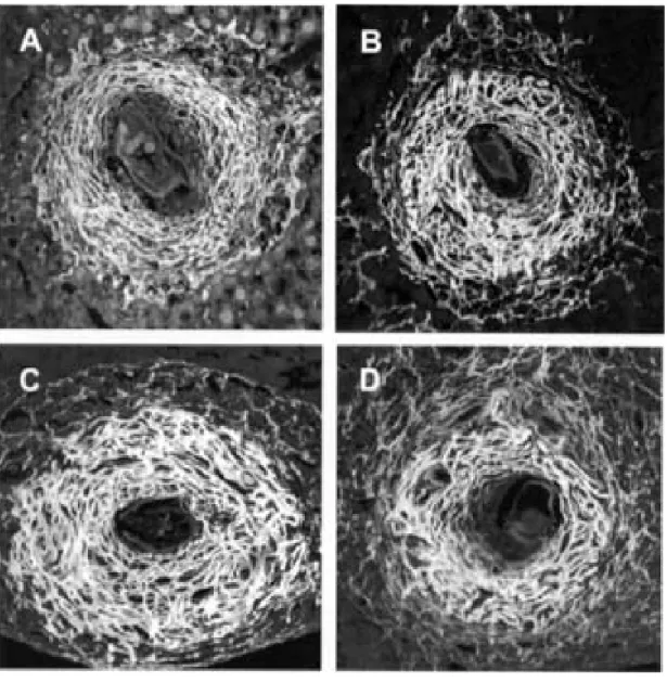 Fig. 5: confocal Images  The figures shows hepatic granulomas in exudative-produtive stage with similar aspects in both subgroups of infected animals, treated and non-treated with pentoxifylline (PTX)