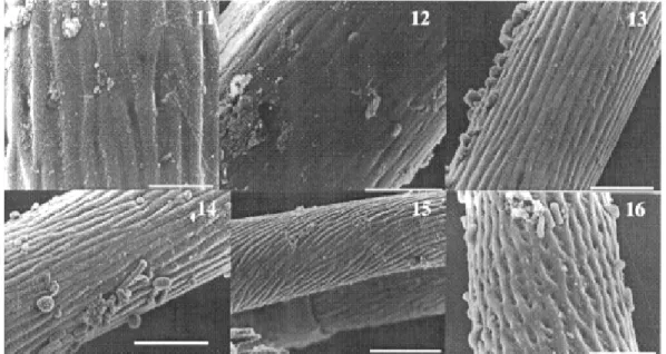 Fig. 11: Lutzomyia longipalpis caudal setae (bar = 1.38 µm). Fig. 12: L. intermedia/L