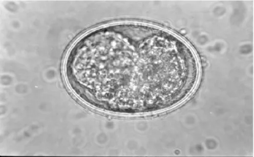 Fig. 6: infective stage of Ascaris lumbricoides egg detected in a soil sample.