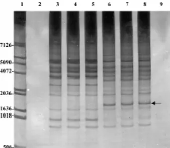 Fig. 5 corresponds to the electrophoresis in gel of polyacrylamide resultant from the amplification of genomic DNA with primer 12 (5’-AGGGAACGAG-3’)