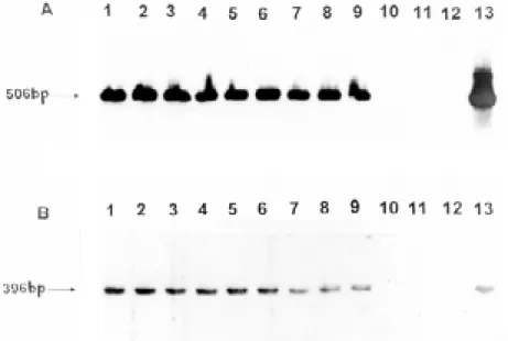 Fig 2: Southern blot hybridization patterns for the same samples shown in Fig. 1, using radiolabeled generic alpha antigen gene (A) and Mtp- Mtp-40 (B) fragments.