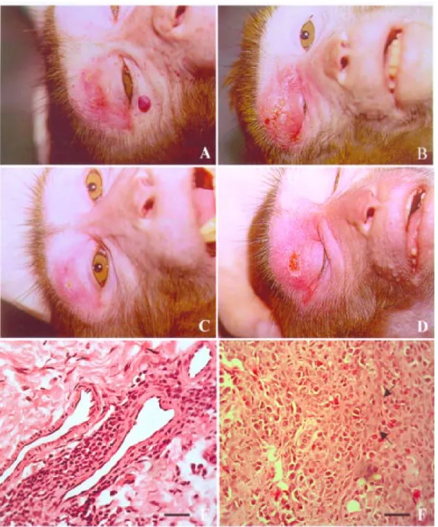 Fig. 5: self-healing cutaneous leishmaniasis in rhesus macaques following challenge with Leishmania (L.) major
