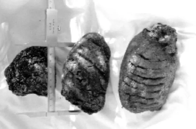Fig. 6: eight fragments composing most of the large colon com- com-pared to a caliper opened to 10 cm.