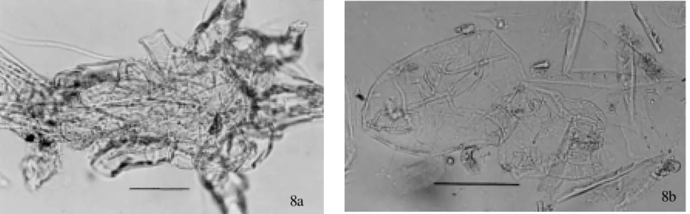 Fig. 9: hypopus of the family Anoetidae (bar = 50 µm). Fig. 10: Chirodiscoides caviae