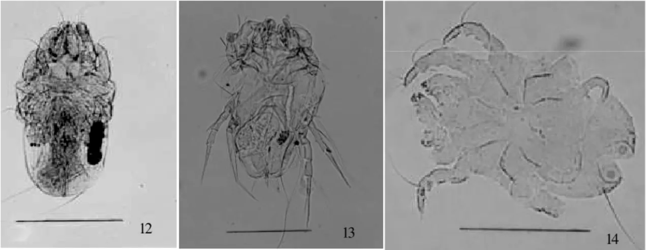 Fig. 12: Suidasia pontifica. Male (bar = 200 µm). Fig. 13: Blomia tropicalis. Female (bar = 200 µm)