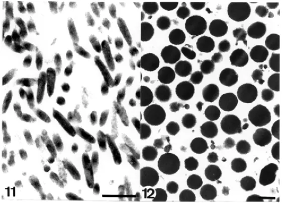 Fig. 13 shows a thin section of Tritrichomonas foetus, where the main structures and organelles observed in members of the Trichomonadidae family are depicted  (re-viewed in Honigberg 1978).